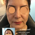 کلینیک لیزر وکلینیک زیبایی پایون(بانوان)