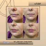 کلینیک زیبایی و لیزر لیزا