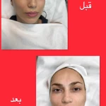خدمات تخصصی پوست  غریبانی (بل اسکین کر)