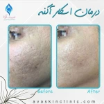 کلینیک پوست و مو آوا