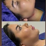 لوگوی کلینیک زیبایی بوکال فت و سوپرکانتور غبغب