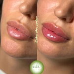 کلینیک زیبایی‌ سلین اسکین سنتر