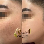 کلینیک زیبایی پارسینا