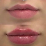 تصویر مطب پوست ،مو،زیبایی(دکتر سمیرا گرجی)