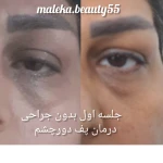 فشیال پاکسازی تخصصی ملکیا سلیمی