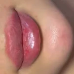 خانه لیزر فیلر و بوتاکس ثنا