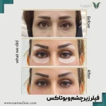  کلینیک پوست ، مو و لیزر نارینا