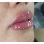 مطب پوست مو زیبایی دکتر معصومه روزگاری