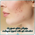 کلینیک  پوست مو زیبایی آلند