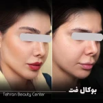 کلینیک زیبایی تهران بیوتی سنتر