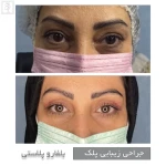تصویر کیلینیک زیبایی آنابلا