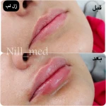 کلینیک پوست مو زیبایی و لیزر نیل