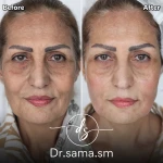 مطب پوست و مو زیبایی دکتر سما