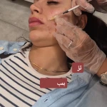 کیلینک پوست مو و لیزر نورا