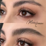 تصویر میکروبلیدینگ و شیدینگ مینا حسینی