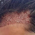 کلینیک فوق تخصصی پوست و مو و لاغری بنیتا