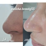 فشیال پاکسازی تخصصی ملکیا سلیمی