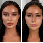 کلینیک زیبایی و لاغری بلو بیوتی رویال