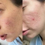 مرکز لیزر کلینیک زیبایی دنیای نقره ای