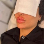 نمونه کار مرکز زیبایی آیچین