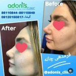 کلینیک پوست مو زیبایی و لیزر آدونیس