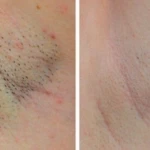 کلینیک لیزر و زیبایی یگانه