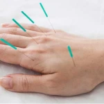 مرکز لیزرو پوست و طب سوزنی الماس تابان