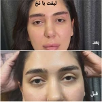کلینیک زیبایی و لیزر مو گندم