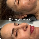 تصویر کلینیک زیبایی فشیال دکتر هدیه دهقان پور