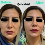 تصویر کلینیک پوست مو زیبایی و لاغری باران