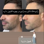 مرکز لیزر کلینیک زیبایی رزنیلای مرزداران