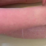 کلینیک پوست مو زیبایی و لیزر ونوشه