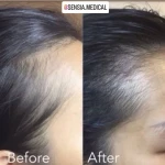 کلینیک زیبایی و مرکز لیزر سنسیا