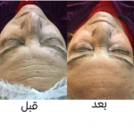 پاکسازی و جوانسازی پوست سمیرا صادقی