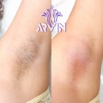 کلینیک زیبایی آروین