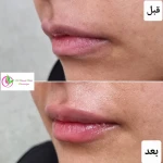 دکتر بهاره ملکی متخصص پوست ، مو و زیبایی