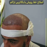 کلینیک تخصصی کاشت مو و ابرو رویش سبز