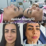 فشیال پاکسازی تخصصی ملکیا سلیمی