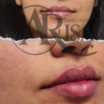 کلینیک زیبایی و مرکز لیزر موی زائد آریسا