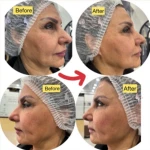 نمونه کار کلینیک پوست مو لیزر سیمارز