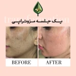 کلینیک زیبایی و مرکز لیزر آیه نقی زاده