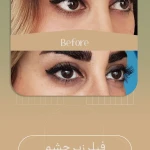 کلینیک پوست مو زیبایی حضور