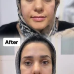 کلینیک زیبایی و لیزر نگین شرق