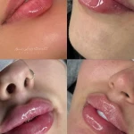 کلینیک زیبایی و مرکز لیزر موی زائد آریسا