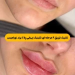 کلینیک زیبایی بلا