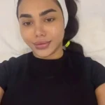 خدمات تخصصی فیشال و پاکسازی پوست حفظی