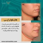 کلینیک پوست ، مو و لیزر نارینا