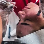 تصویر خدمات تخصصی فیشیال و‌‌ پاکسازی پوست پگاه