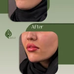 کلینیک پوست مو زیبایی حضور