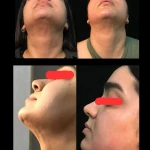 نمونه کار کلینیک زیبایی و لاغری زیباترشو
